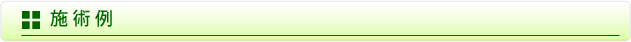 施術例
